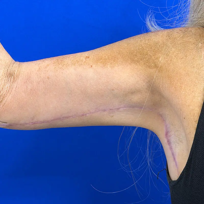 Patient Before & After Photo