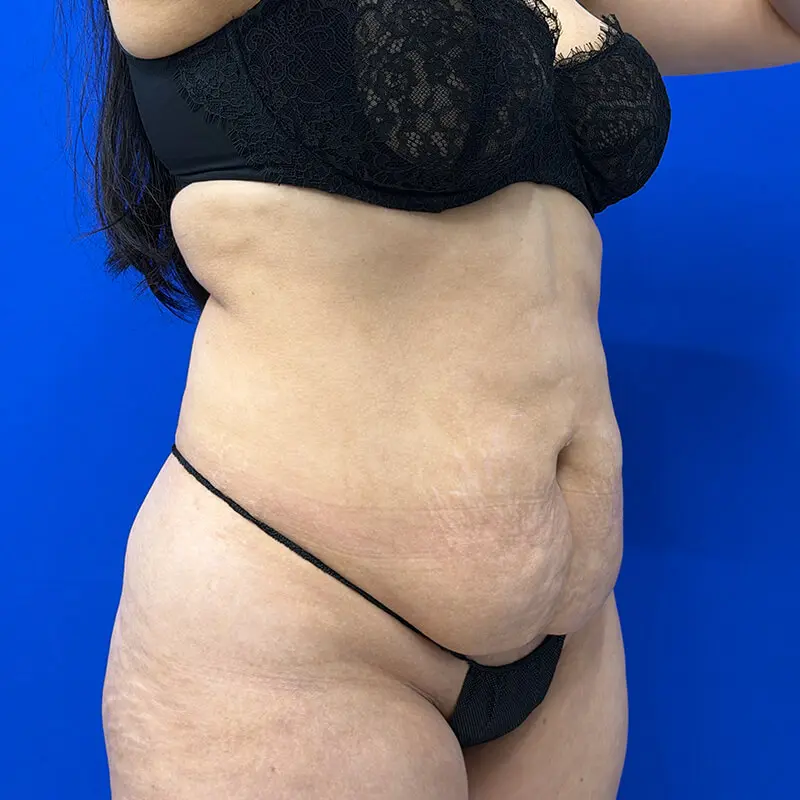 Patient Before & After Photo